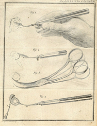 instruments for cataract extraction