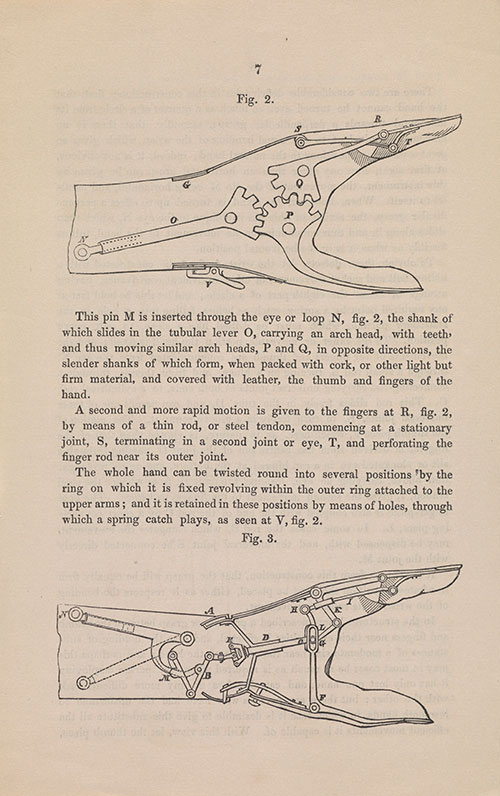 Fig.2.CayleyHandsm description of an articifial hand by Cayley