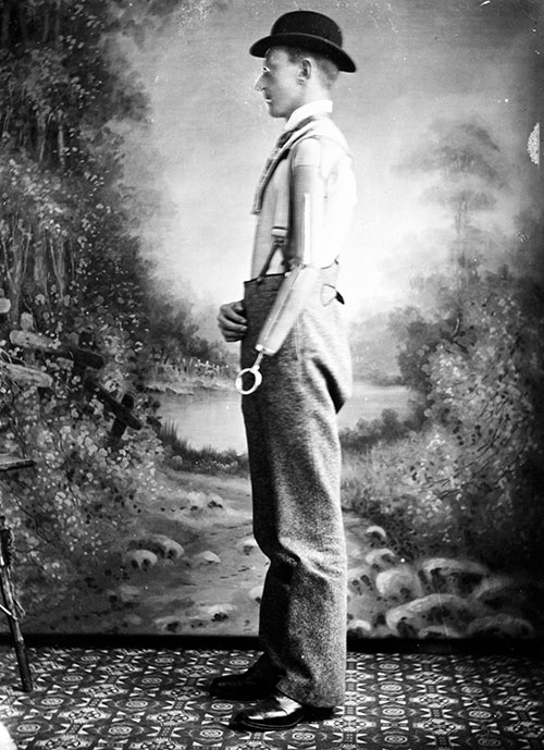 Fig.9.Gillingham3sm Gillingham photo of man wearing artificial arm