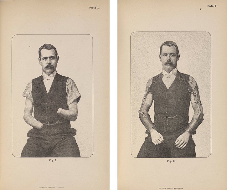 Figs6_and_7 Ernst engravings